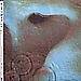 Meddle